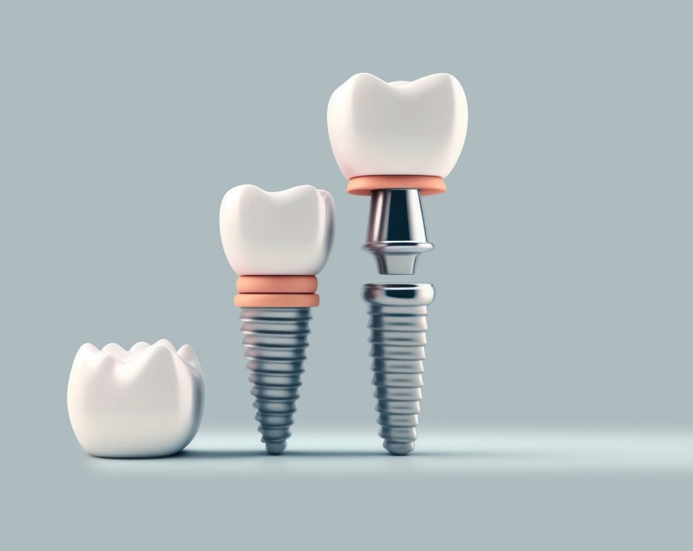 Implantologie Dentaire Bahr Tanger