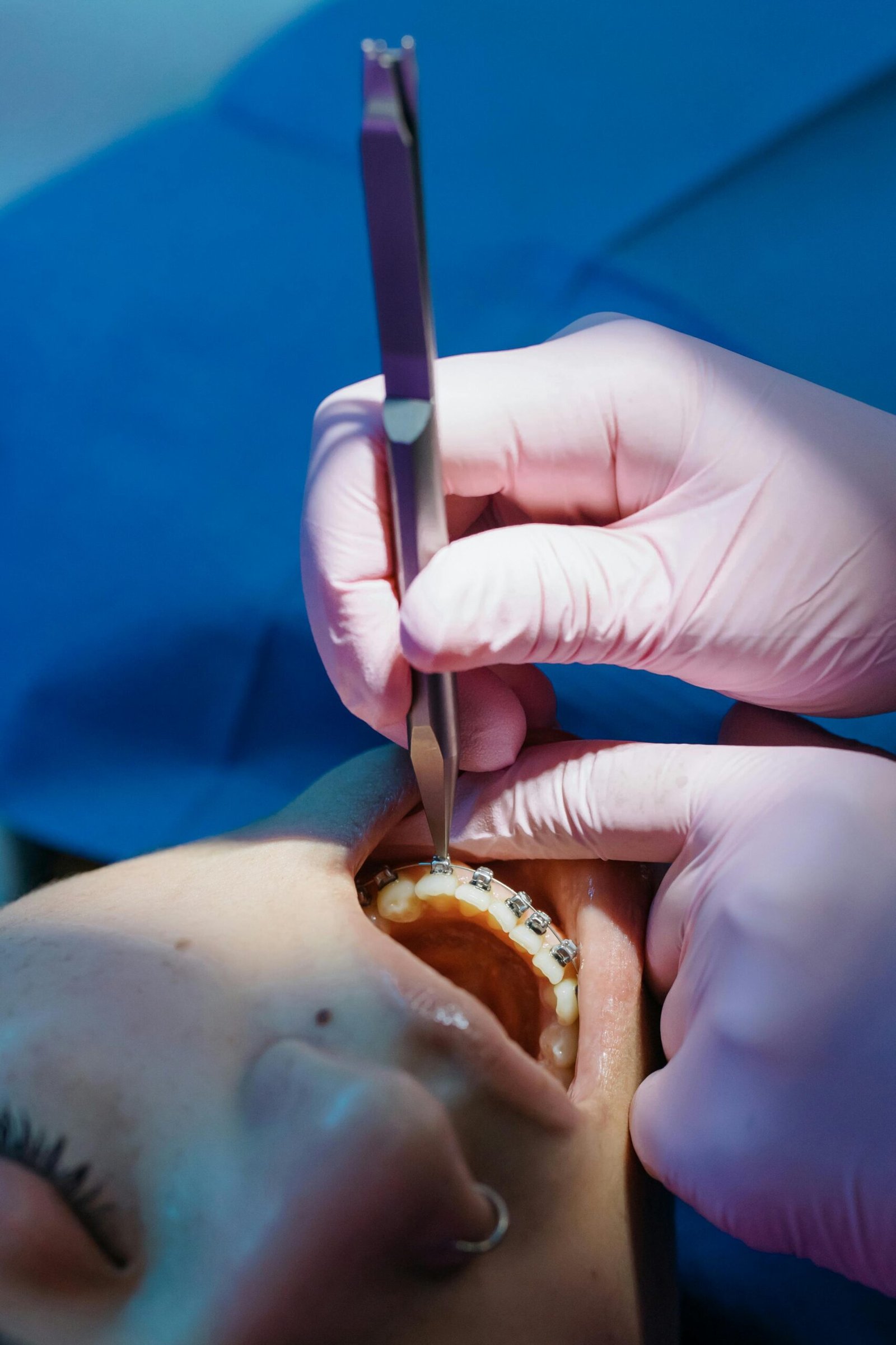 Chirurgien dentiste et orthodontiste travaillant ensemble sur un plan de traitement à Tanger